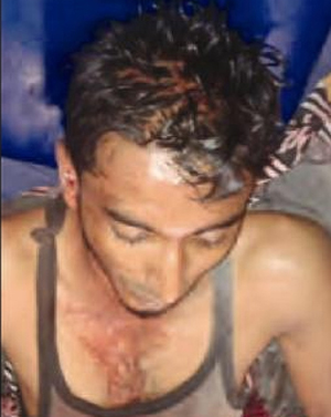 assaulted